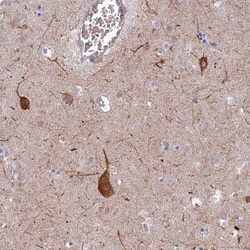 RHBDL2 Antibody, Novus Biologicals 0.1mL; Unlabeled:Antibodies, Polyclonal